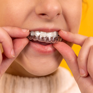 Dental Acrylic Resin
